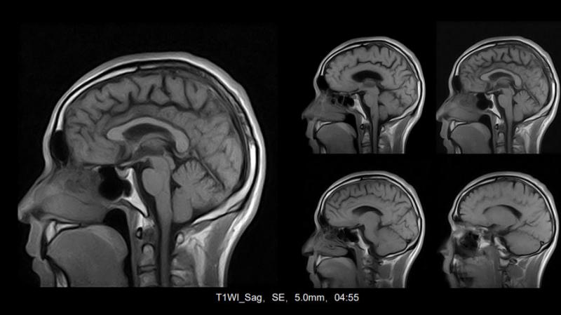 Basda MRI BTI-030